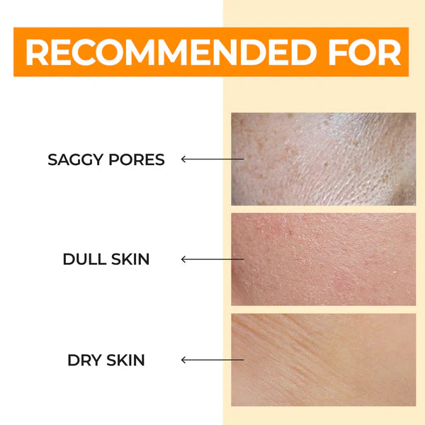 Product recommendations for saggy pores, dull skin, and dry skin on a beige background.