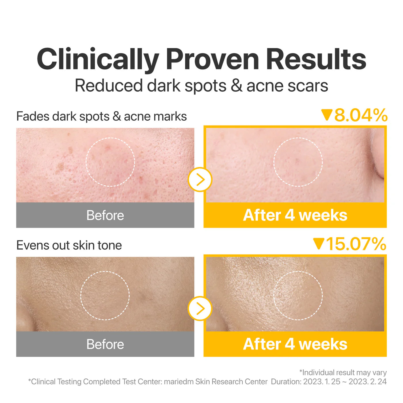 Before and after skin treatment results showing reduced dark spots and acne scars with clinical data.