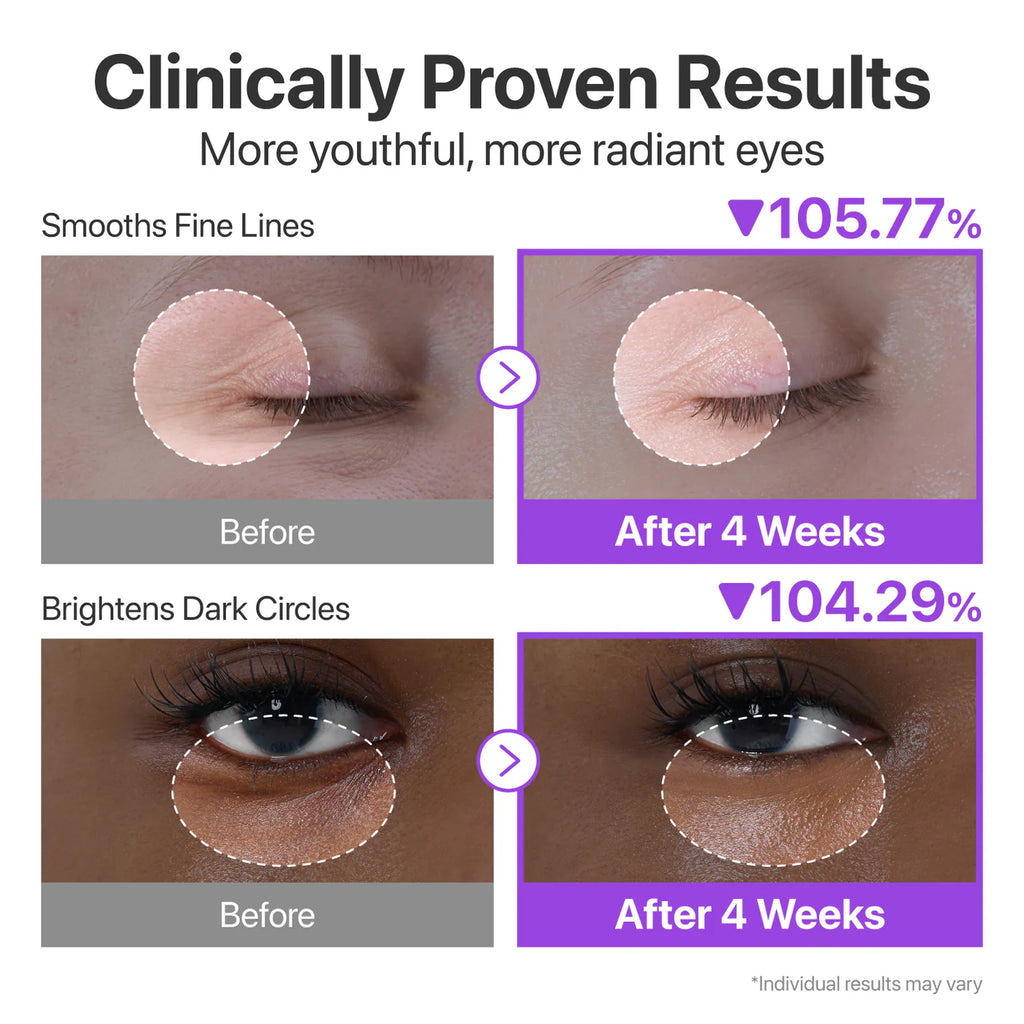 Before and after effects of eye cream on fine lines and dark circles with statistical percentages.