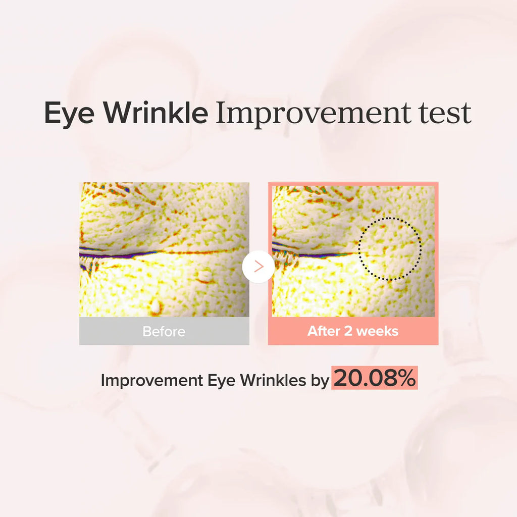 Before and after test of eye wrinkle improvement with visible reduction.